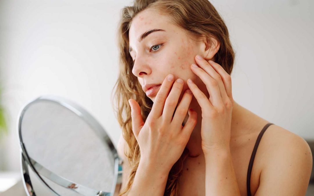 Deine Hautpflege sabotiert deine Hormone